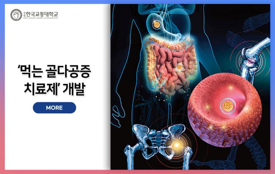 ‘먹는 골다공증 치료제’ 개발