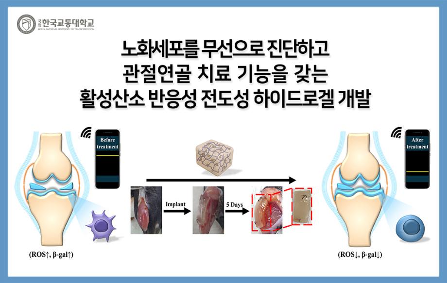 노화세포를 무선으로 진단하고 관절연골 치료 기능을 갖는 활성산소 반응성 전도성 하이드로겔 개발