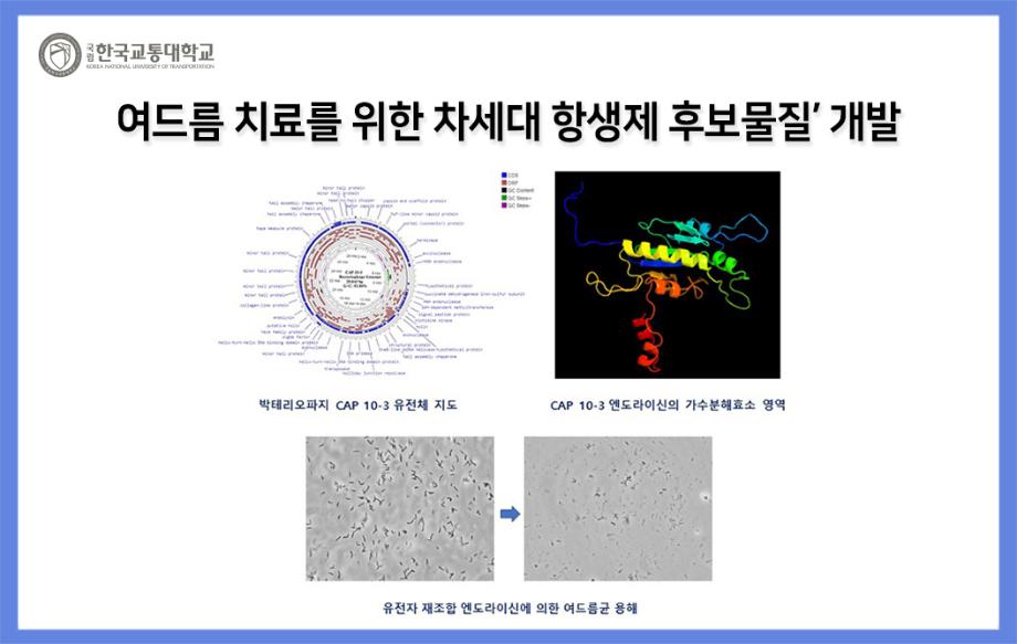 여드름 치료를 위한 차세대 항생제 후보물질 개발